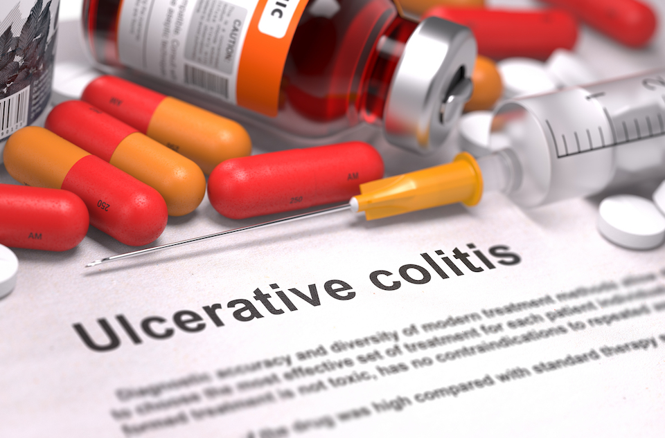 Microbiotica Collaborates with University of Adelaide to Develop a Novel Microbial Therapy for Ulcerative Colitis