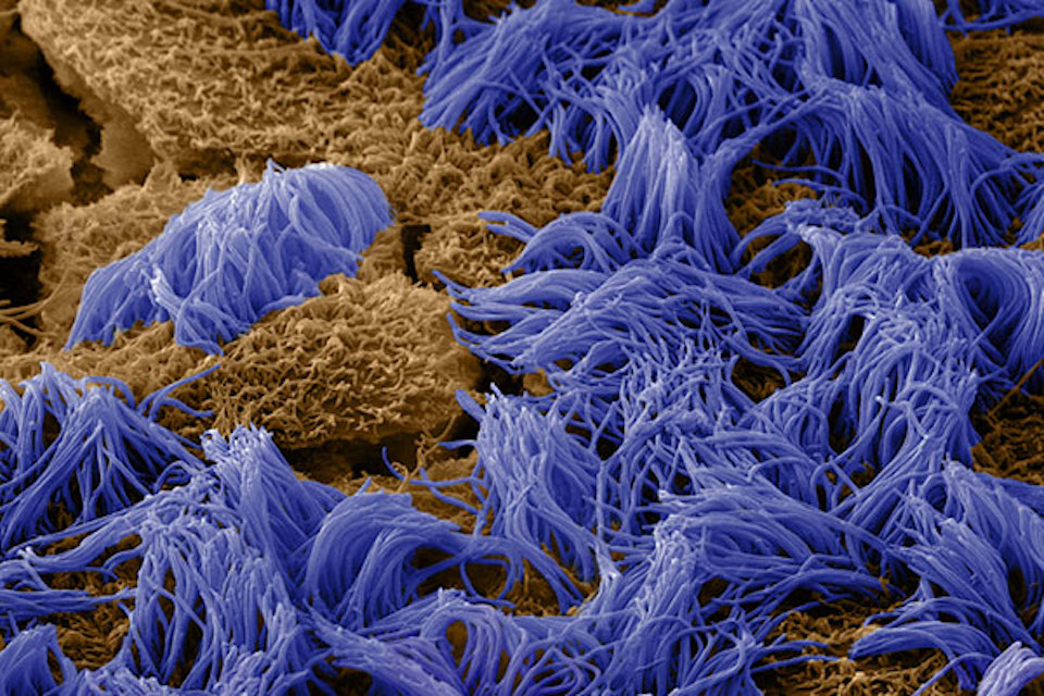 Wyss Institute Receives Grant from Cystic Fibrosis Foundation