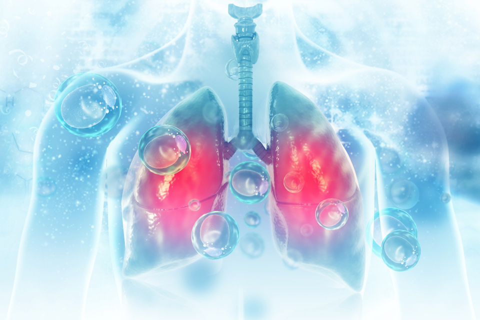 Gram-negative Bacteria Increase Mortality, Vasopressor use and ICU Admission in ILD Patients