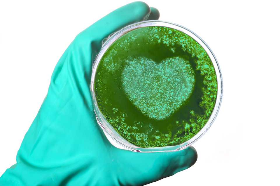 Gut Bacteria May Play Role in Heart Attack Recovery