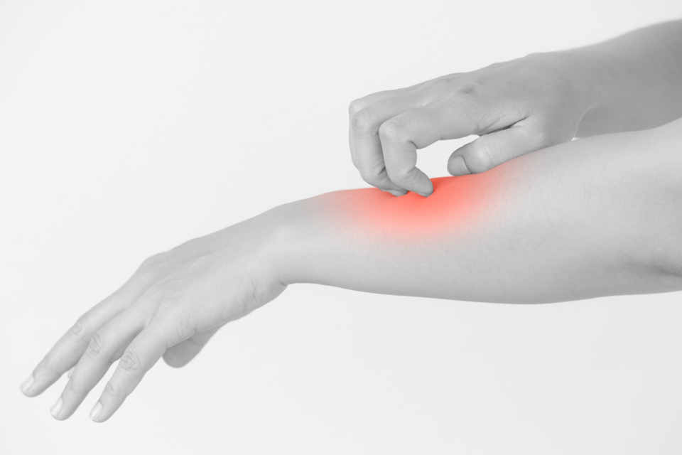 AOBiome Expands Intellectual Property Estate with U.S. Patent for Use of Ammonia Oxidizing Bacteria for the Treatment of Eczema