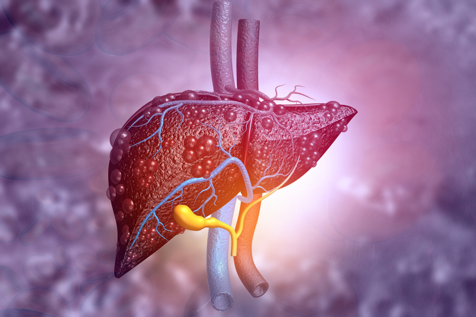 Second Genome Doses First Patient In Phase 2 Clinical Study Of SGM-1019 For NASH