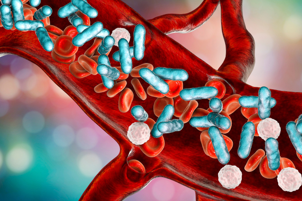 DuPont to Provide Probiotics for International Pediatric Sepsis Research