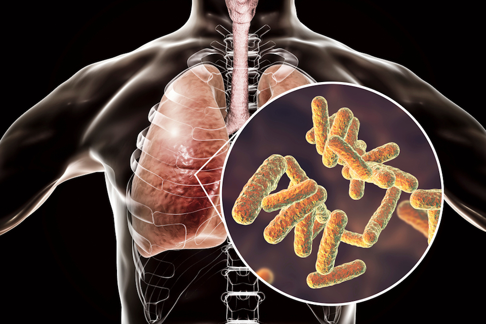 4D pharma plc Commences Phase I/II Asthma Trial
