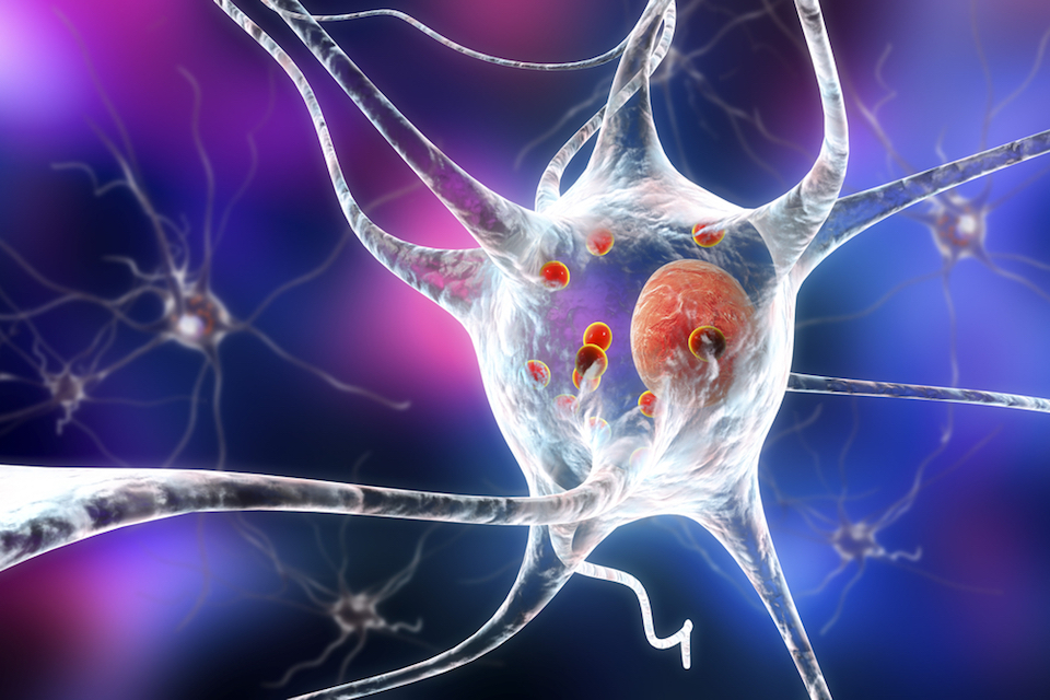 New Research shows link between Parkinson’s disease and the microbiome