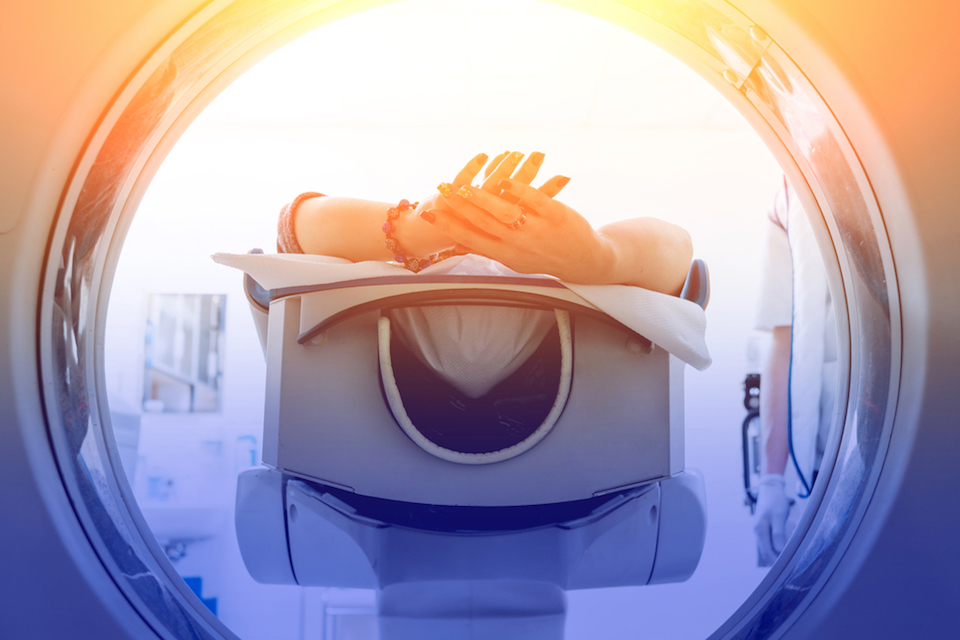 Gut bacteria ‘fingerprint’ predicts radiotherapy side effects
