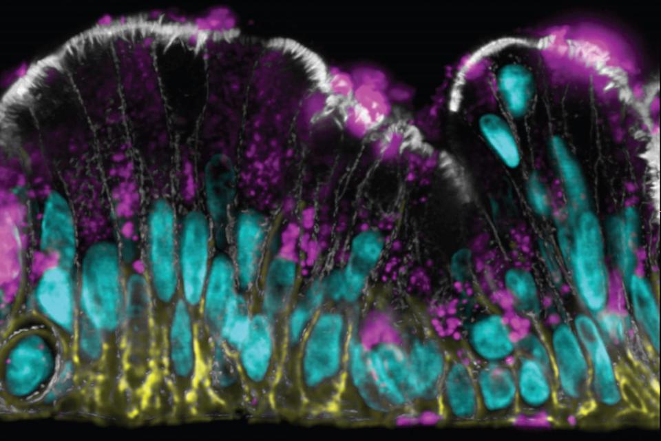 Investigating the human intestinal mucus barrier up-close and personal