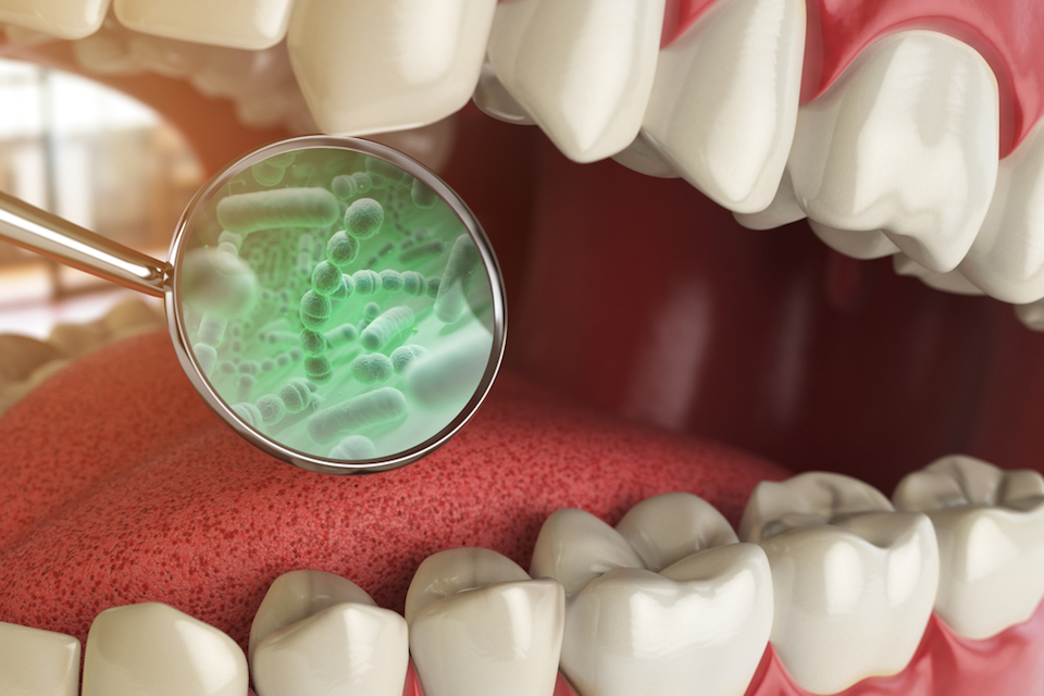 Microbes in dental plaque look more like relatives in soil than those on the tongue