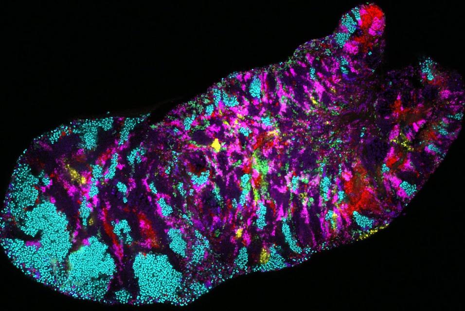 The incredible, variable bacteria living in your mouth