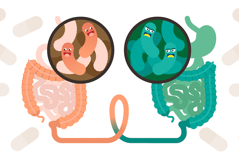 Fecal transplant turns cancer immunotherapy non-responders into responders
