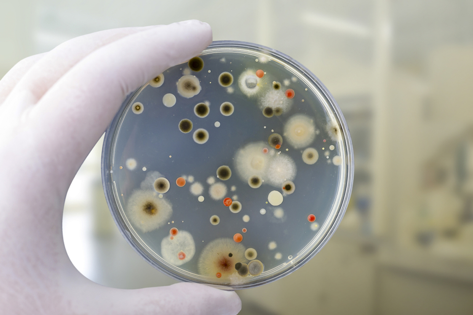 Study suggests that gut fungi are not associated with Parkinson’s disease