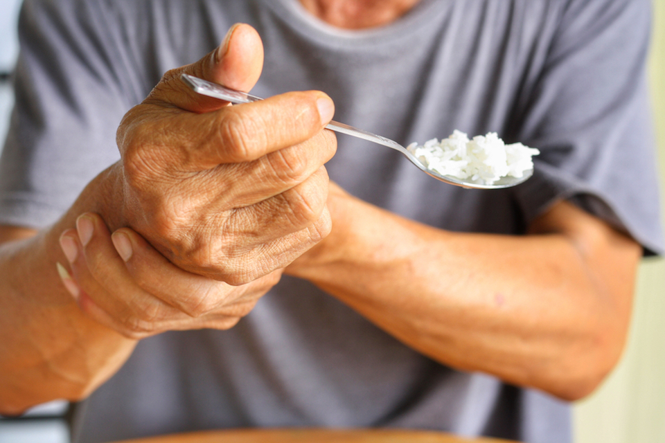 MIND and Mediterranean diets associated with later onset of Parkinson’s disease