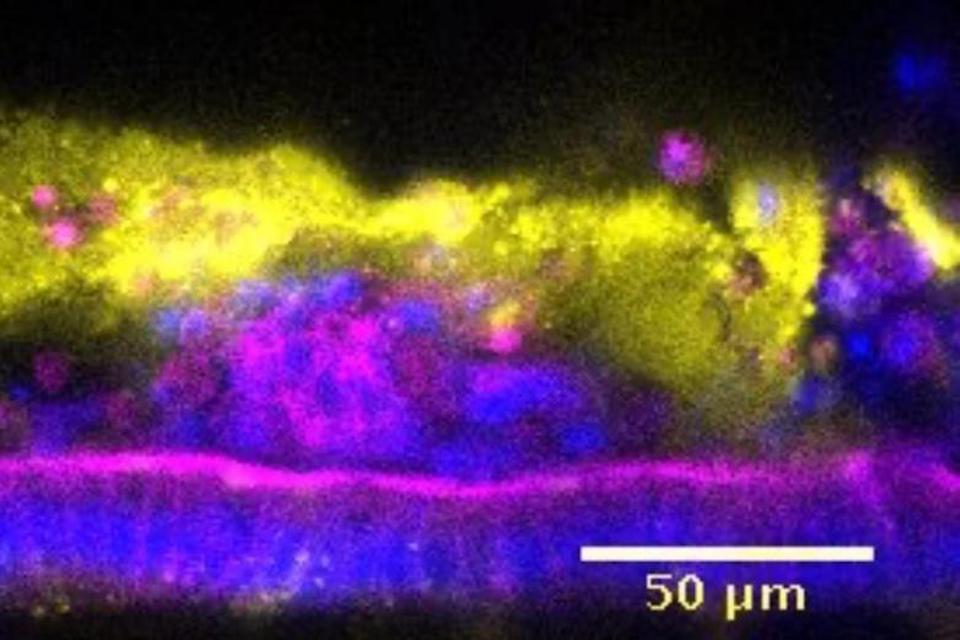Of mice and men and their different tolerance to pathogens