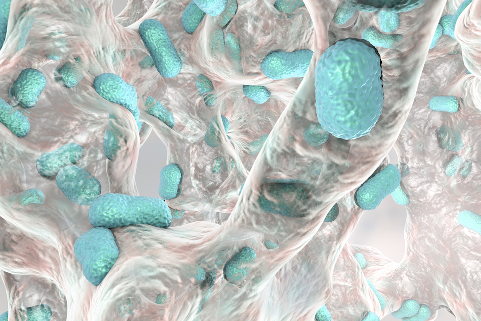 Researchers discover new hiding place for antibiotic resistance