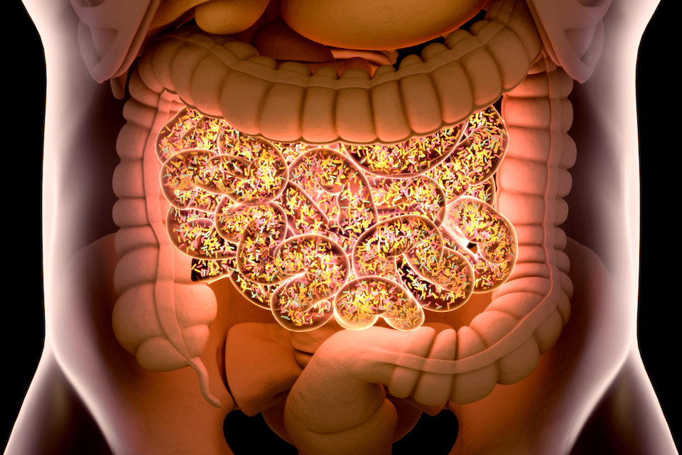 BioGaia’s probiotic reduces inflammation in patients with diverticulitis