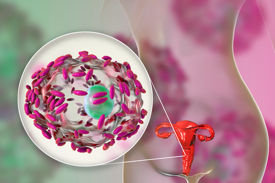 Researchers identify potential approaches to modify the vaginal microbiome