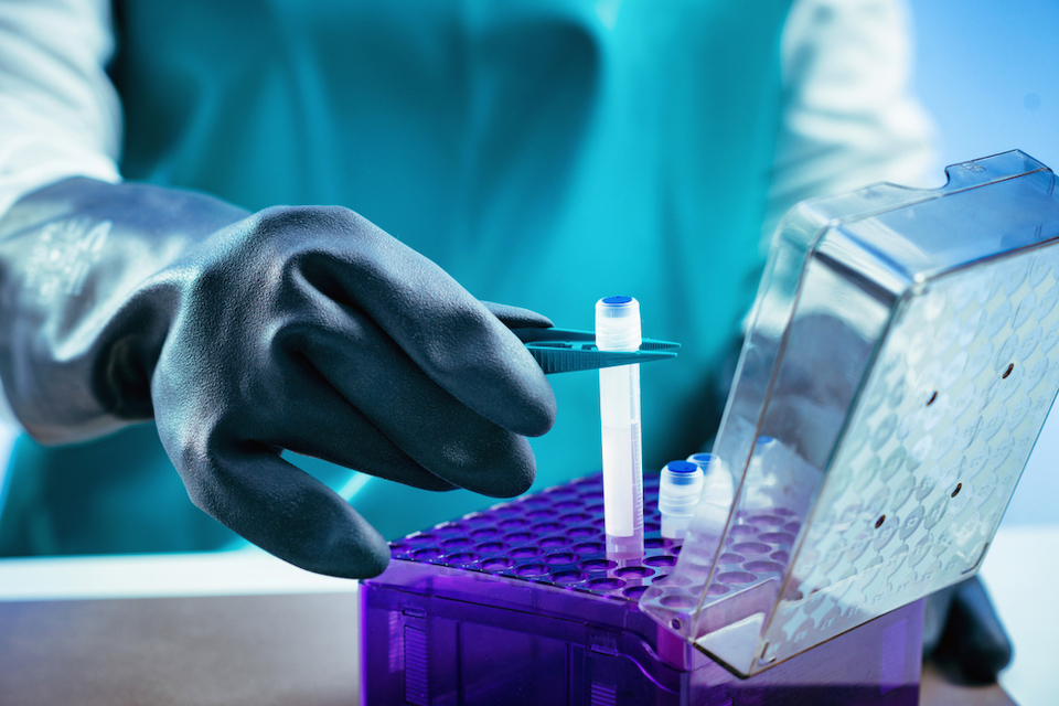 Researchers propose widespread banking of stool samples for fecal transplants later in life