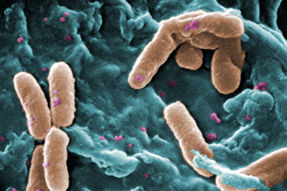 NIH-supported clinical trial of phage therapy for cystic fibrosis begins