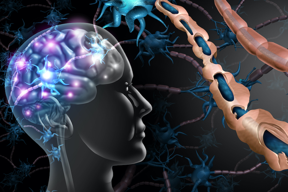 Engineered probiotic developed to treat multiple sclerosis