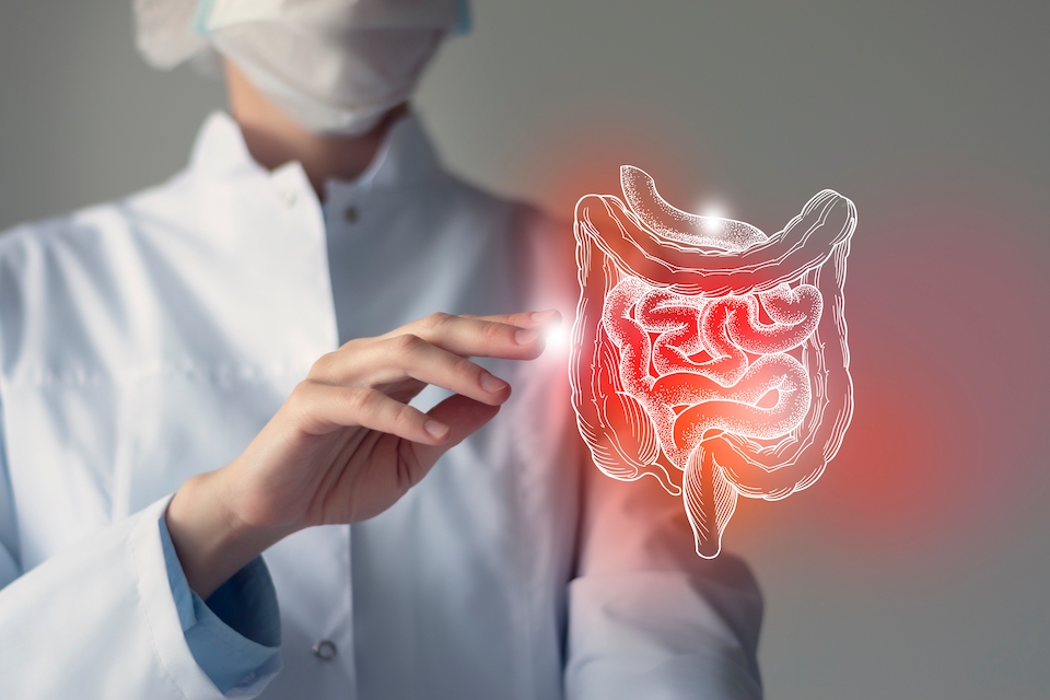 MRM Health Reports Positive Topline Results from Phase 2a Clinical Study with MH002 in Mild-to-Moderate Ulcerative Colitis