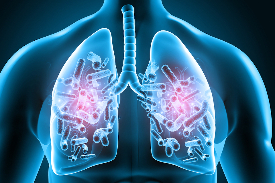 BiomX Announces Positive Topline Results from Part 2 of the Phase 1b/2a Trial Evaluating BX004 for Treatment of Chronic Pulmonary Infections in Patients with Cystic Fibrosis