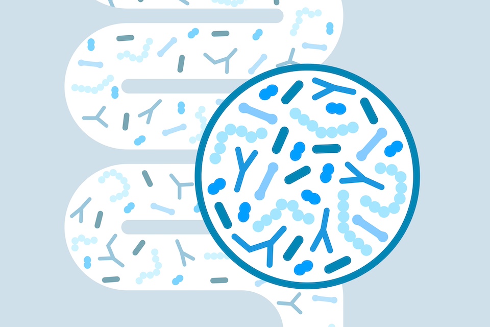 Siolta Therapeutics Raises $12 Million in Series C Financing for Clinical Development