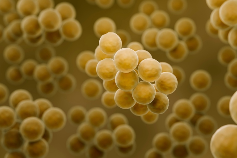 Phage lysin compound HY-133: Start of clinical phase I “first-in-human” study to eliminate Staphylococcus aureus
