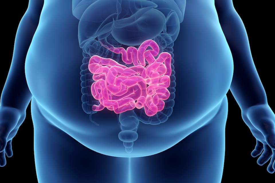 Study finds significant health benefits in adolescents with obesity treated with FMT